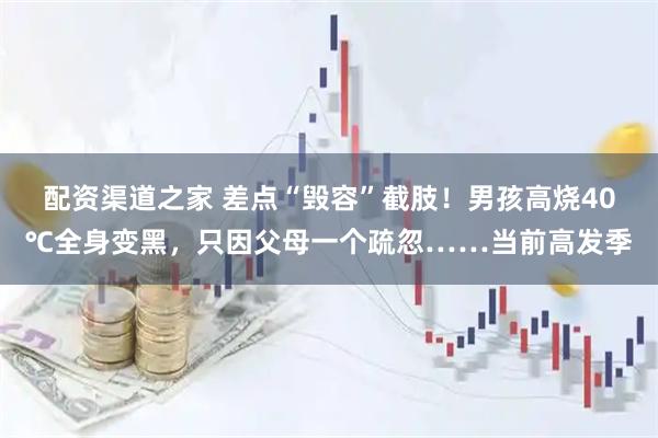配资渠道之家 差点“毁容”截肢！男孩高烧40℃全身变黑，只因父母一个疏忽……当前高发季